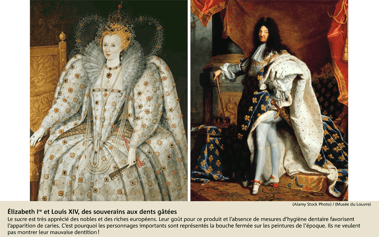 Élizabeth Ire et Louis XIV, des souverains aux dents gâtées
